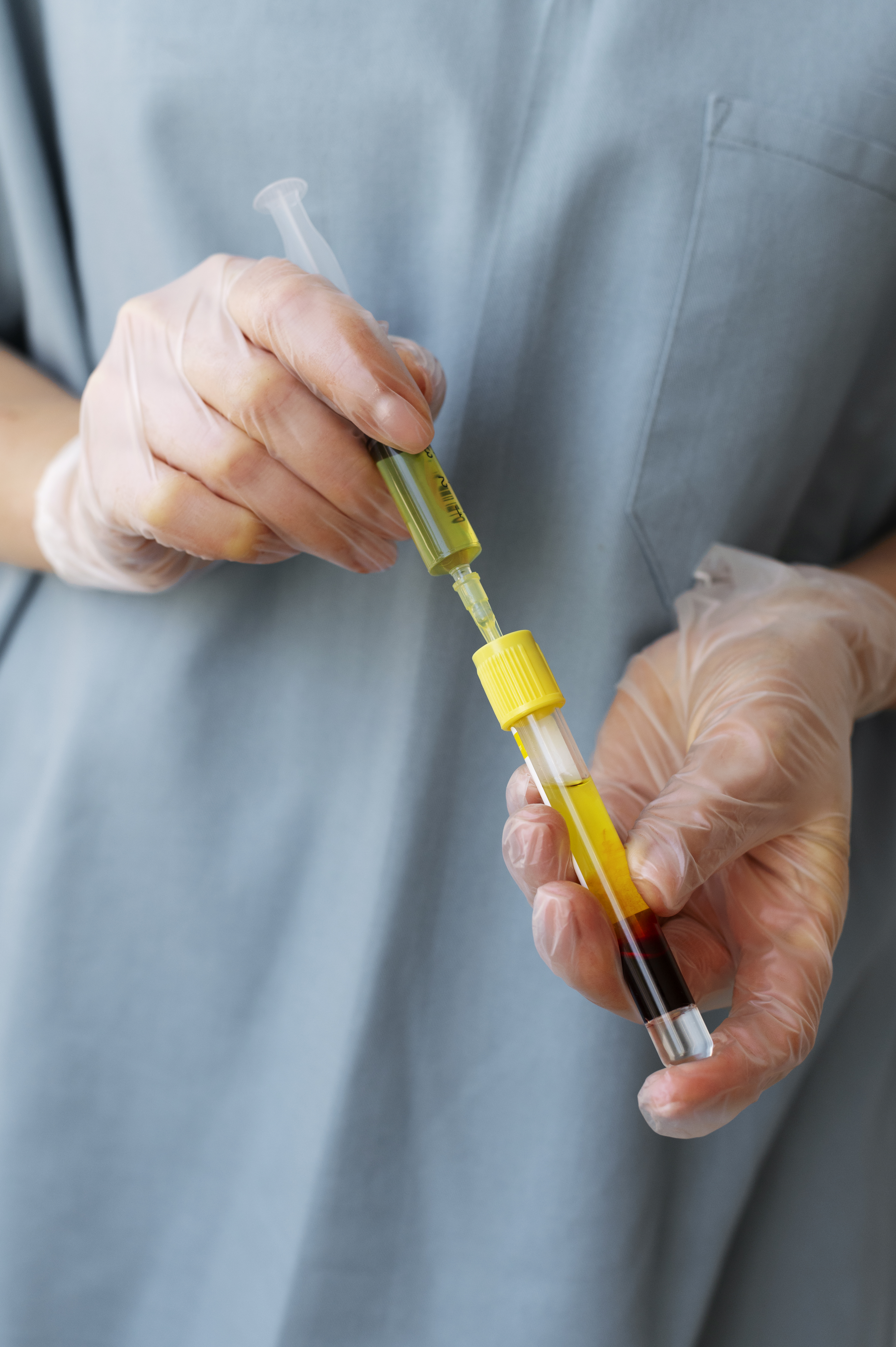 Fat Injection to the Genital Area