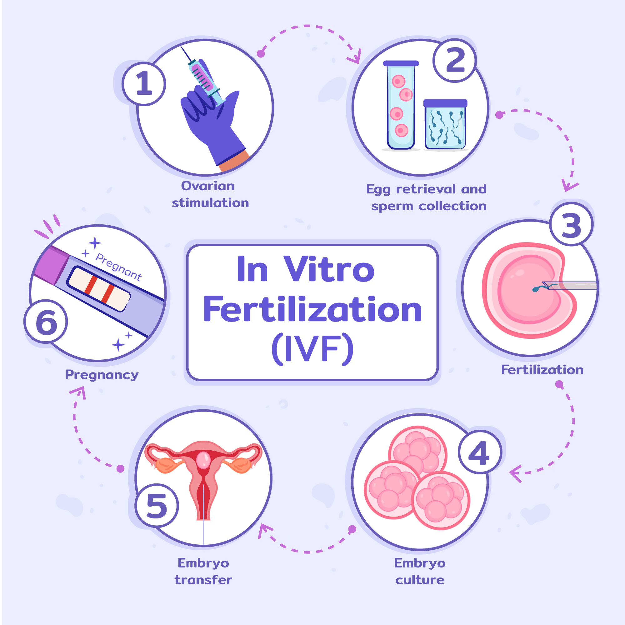  Tüp Bebek (IVF) Süreci