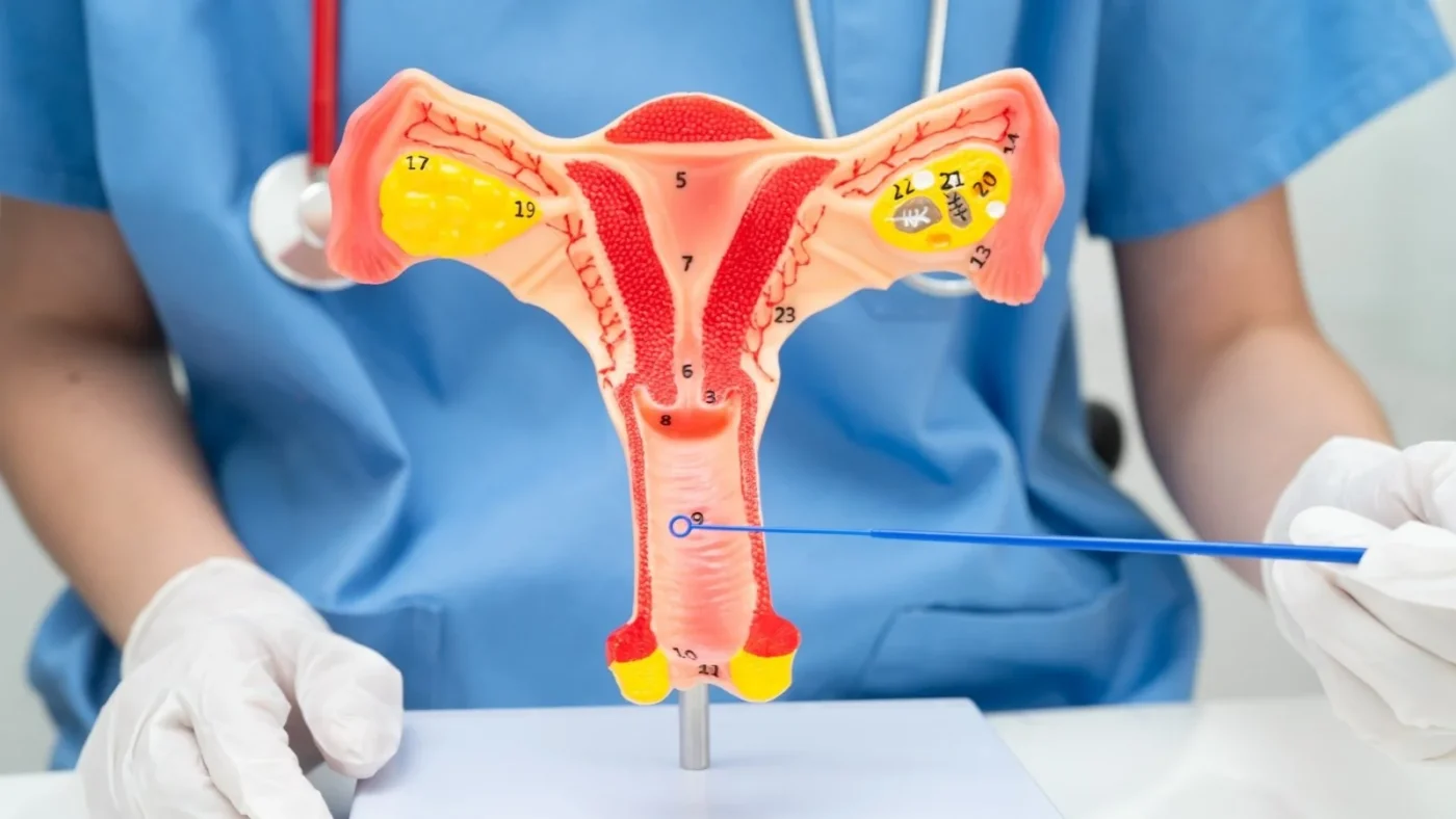 Vajinal Mantar Enfeksiyonu